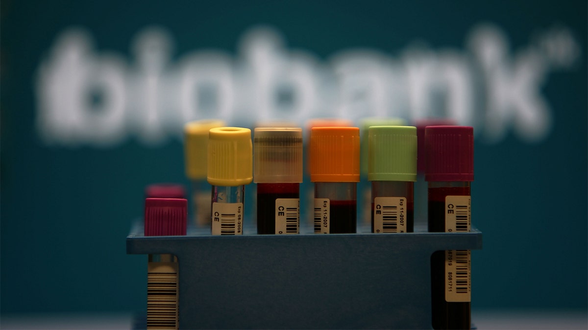 Blood samples are distributed to the UK Biobank