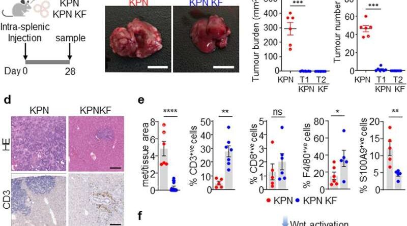 Gene discovery paves way for advanced treatment of pancreatic and colorectal cancer